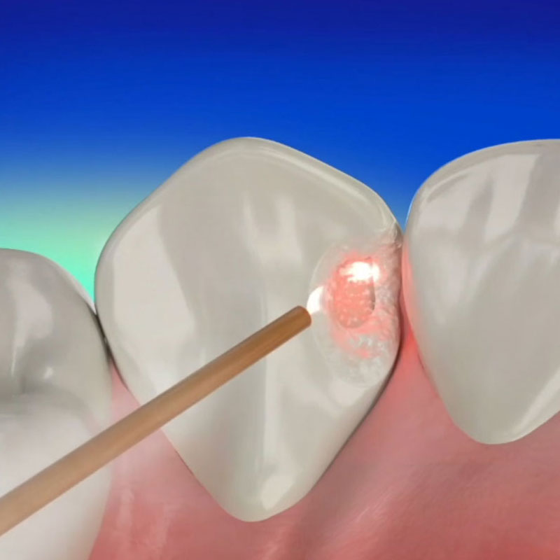 Dental implant training Nairobi