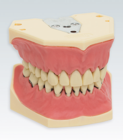 A-PZ Periodontitis Model