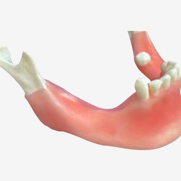 BONE AUGMENTATION - REGENERATION - BA 10