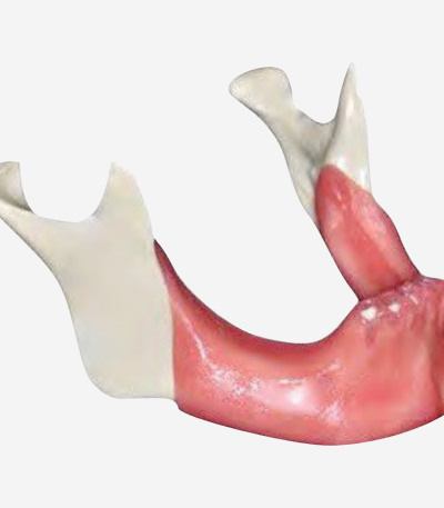 BONE AUGMENTATION - REGENERATION - DM 902