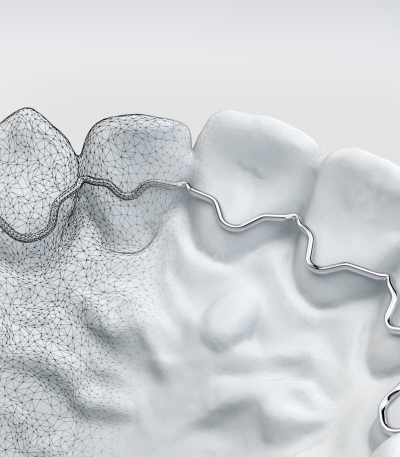 Digital orthodontics -