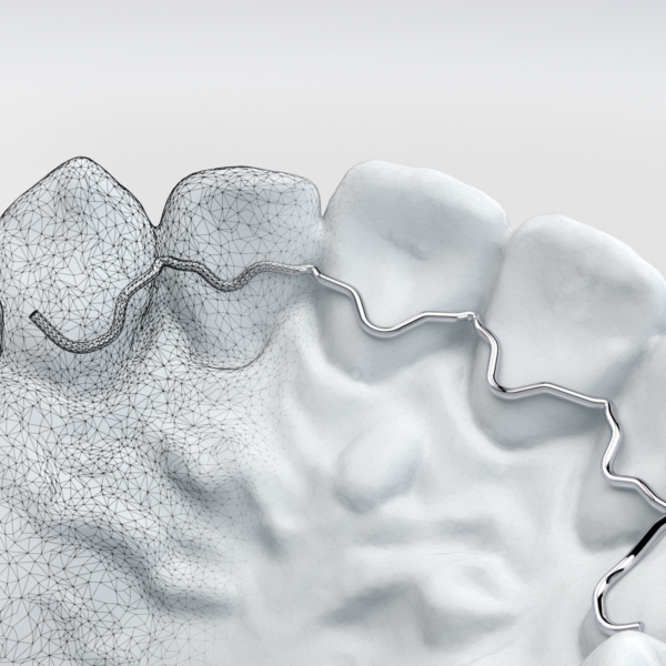 Digital orthodontics -