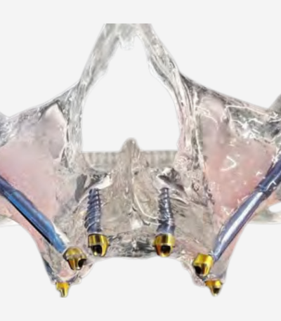 FULL ARCH DIDACTIC MODELS - FA DEMO 2