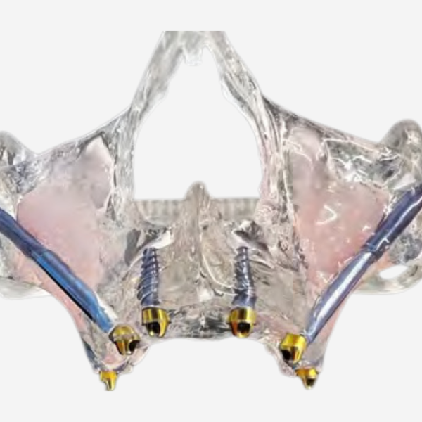 FULL ARCH DIDACTIC MODELS - FA DEMO 2