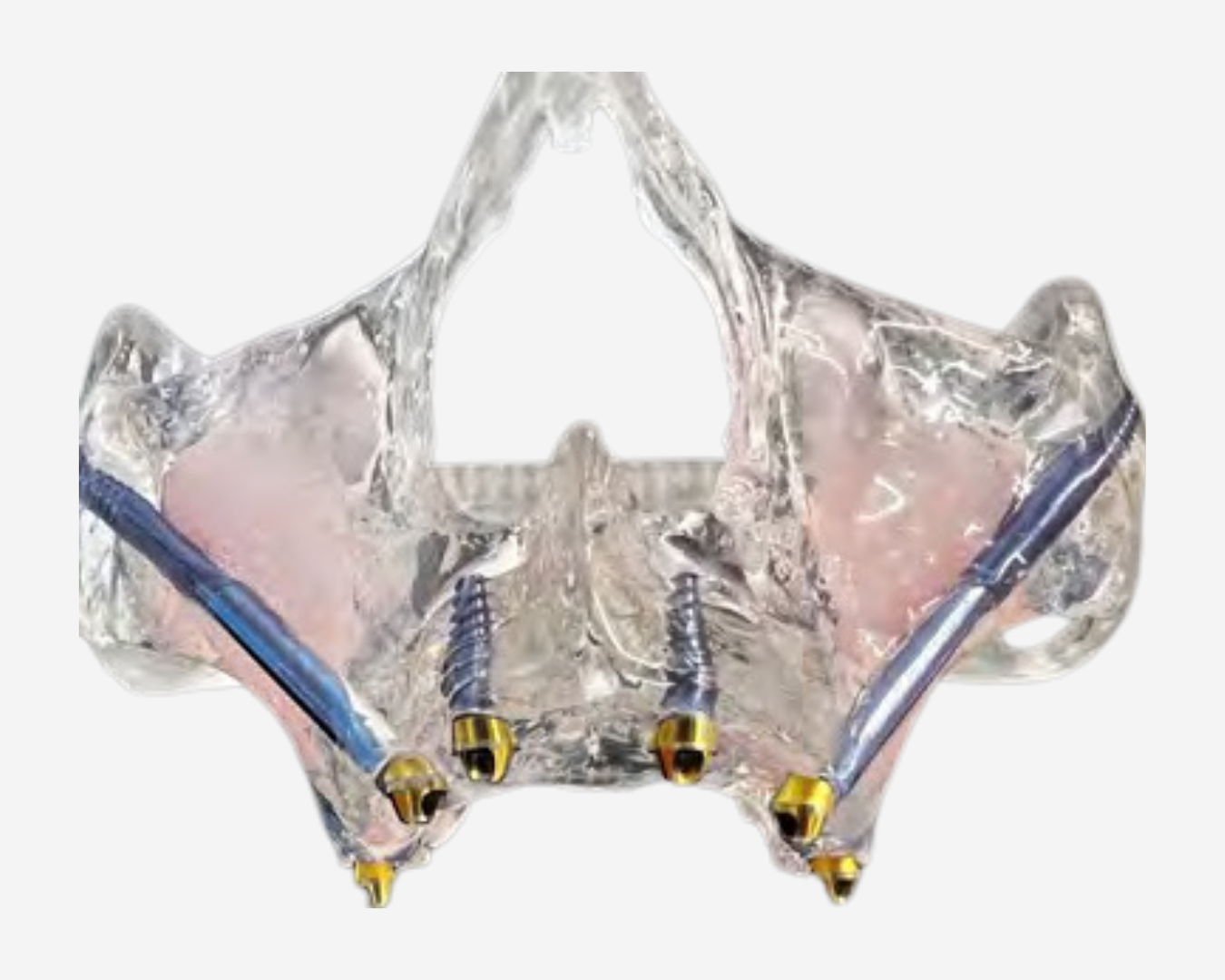 FULL ARCH DIDACTIC MODELS - FA DEMO 2 FULL ARCH DIDACTIC MODELS - FA DEMO 2