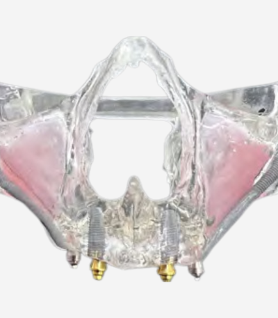 FULL ARCH DIDACTIC MODELS - FA DEMO 3