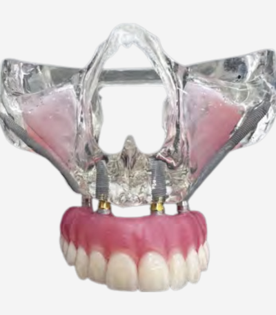 FULL ARCH DIDACTIC MODELS - FA DEMO 4