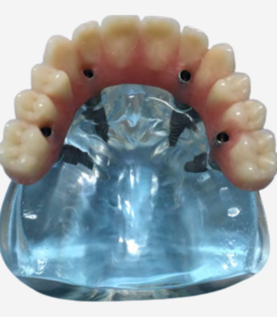 FULL ARCH DIDACTIC MODELS - FA DEMO 8
