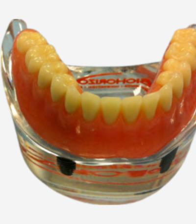 FULL ARCH DIDACTIC MODELS - FA DEMO 9