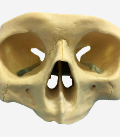 FULL ARCH TREATMENT MODELS - ZYG 101