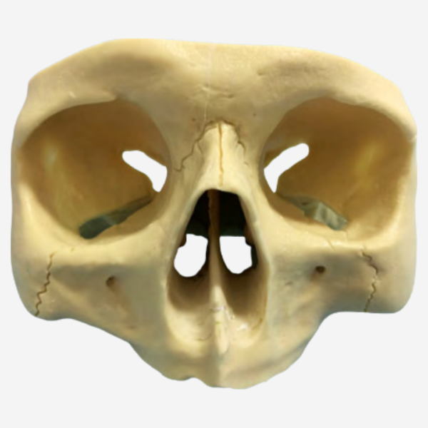 FULL ARCH TREATMENT MODELS - ZYG 101