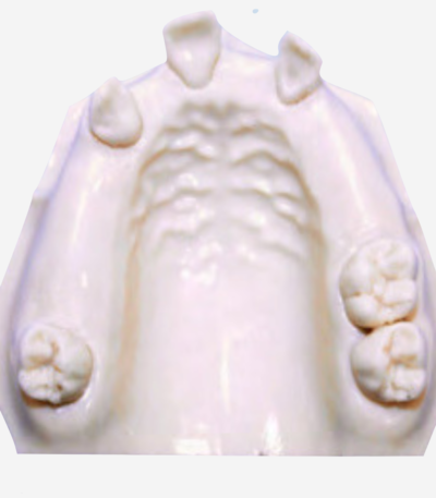 MAXILLA MODELS - DM 102
