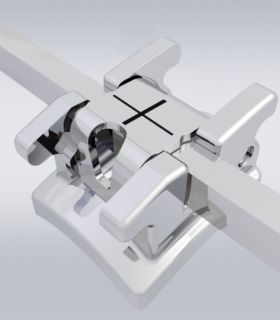 Self-ligating brackets -