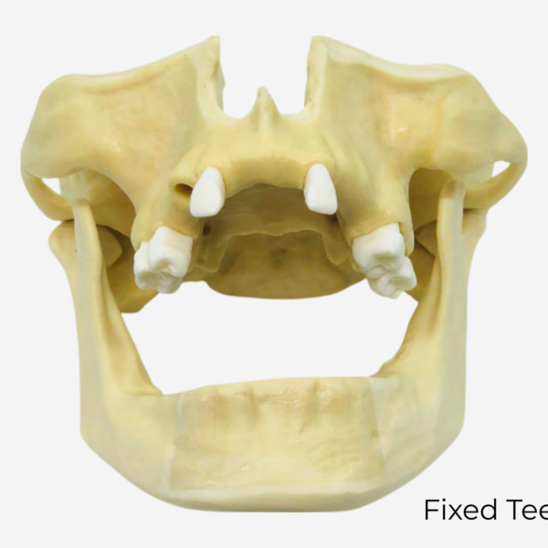 SINUS LIFT MODELS - DM 132-2