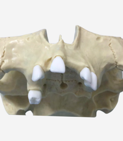 SINUS LIFT MODELS - DM 134