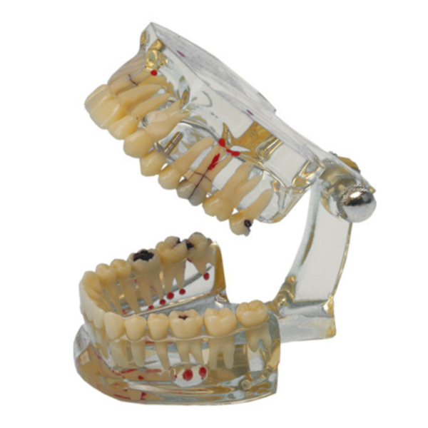 Hager & Werken Study Model Transparent Plus 355640