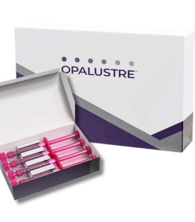 Ultradent Opalustre Refill with four 1.2 mL enamel microabrasion slurry syringes